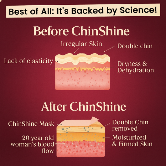ChinShine™ Lift & Sculpt Mask