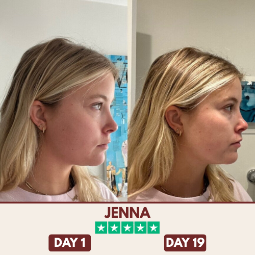 ChinShine™ Lift & Sculpt Mask